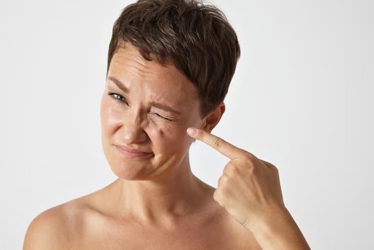 Home Remedies For Under Eye Wrinkles