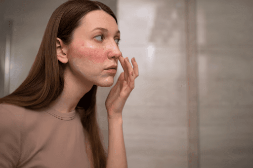 how to reduce redness on face