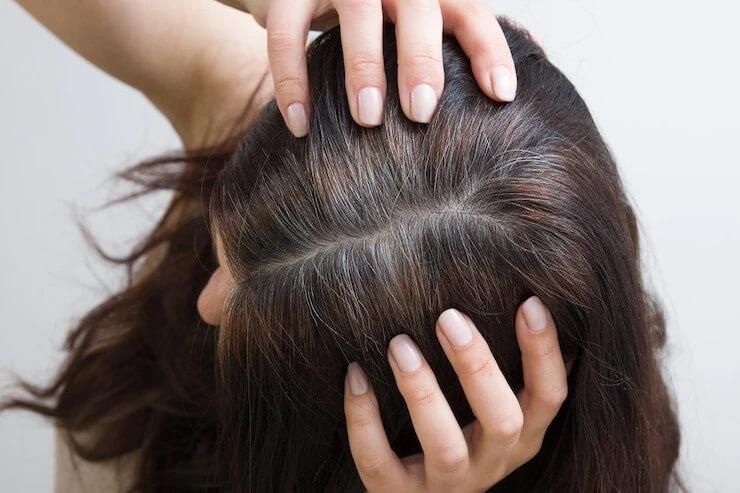 Home Remedies For Premature Greying Of Hair