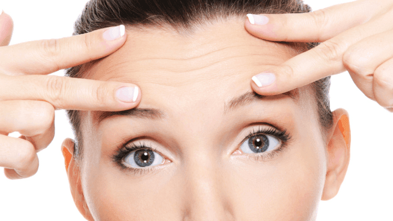 how to remove forehead wrinkles